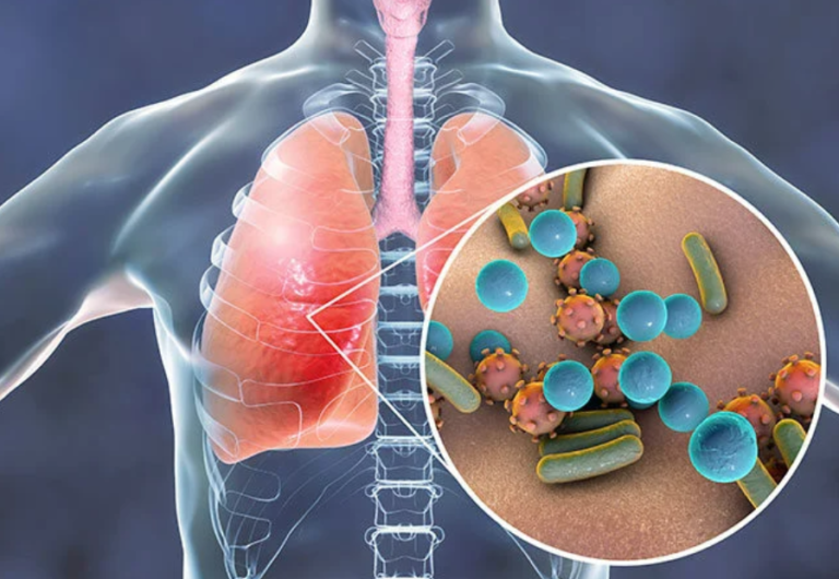 Toothbrushing Cuts Pneumonia Risk In Hospitalized Patients By Over 30