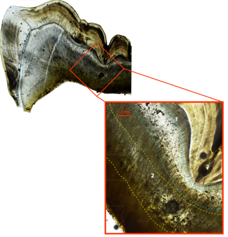 Ground section of the right permanent mandibular first molar of cl 118. Two bands of igd are visible, the first occurring ~birth-6 months (teal dashed lines) and the second occurring between ~1 and 1. 5 years (yellow dashed lines). Large image is 40x total magnification, inset box is 100x total magnification.