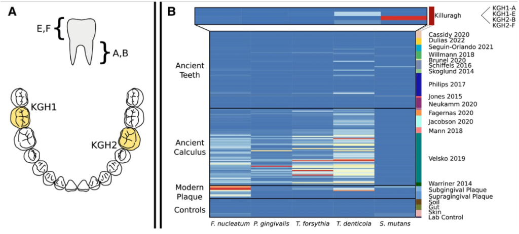 Evolution of the Oral Microbiota – New Data on Bronze Age Teeth
