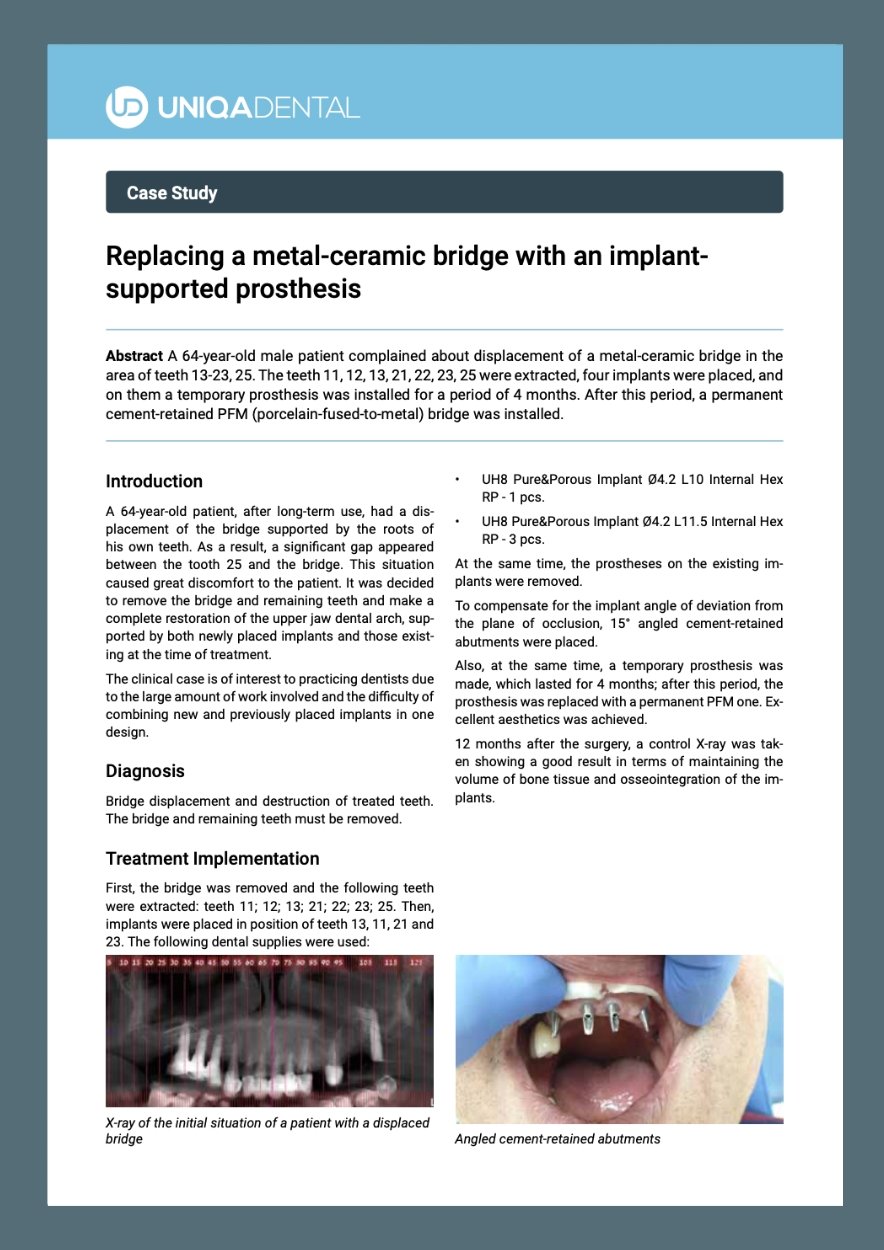 Replacing a metal-ceramic bridge with an implant- supported prosthesis