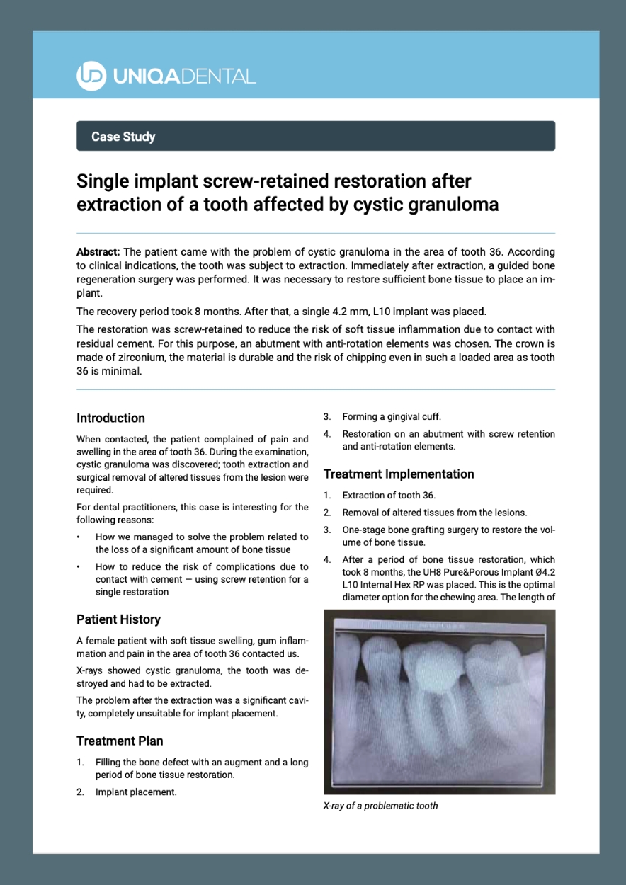 Single implant screw-retained restoration after extraction of a tooth affected by cystic granuloma (pdf)