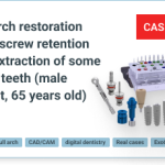 Full-Arch Screw-Retained Implant-Supported Restoration on a Bar with All-on-4 Concept, Accompanied by Tooth Extraction in a 65-Year-Old Male Patient