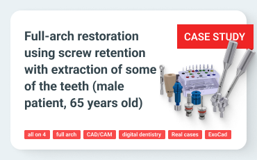 Full-Arch Screw-Retained Implant-Supported Restoration on a Bar with All-on-4 Concept, Accompanied by Tooth Extraction in a 65-Year-Old Male Patient