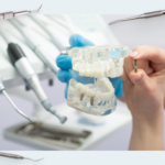 Screw vs. Cement Fixation of Crowns on Implants: Part 1