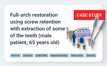Full-Arch Screw-Retained Implant-Supported Restoration on a Bar with All-on-4 Concept, Accompanied by Tooth Extraction in a 65-Year-Old Male Patient
