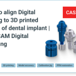 How to align Digital Analog to 3D printed model of dental implant: CAD/CAM Digital Planning