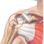 Unexpected results from a study of python teeth: a new approach in shoulder rotator cuff repair in humans