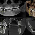 How artificial intelligence is changing dental treatment capabilities