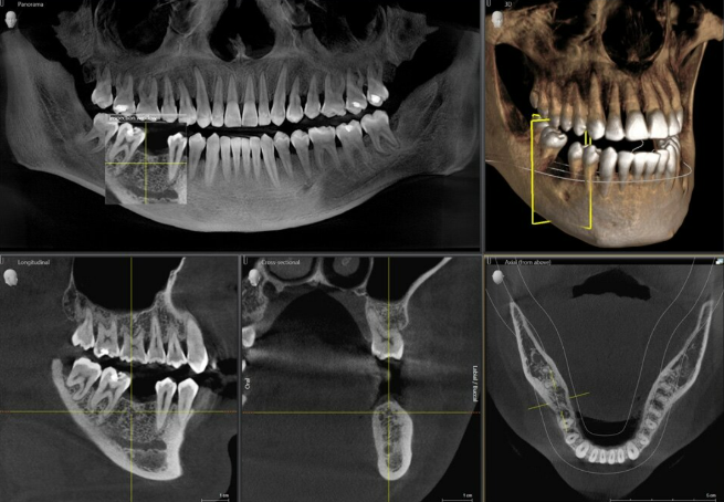 How artificial intelligence is changing dental treatment capabilities