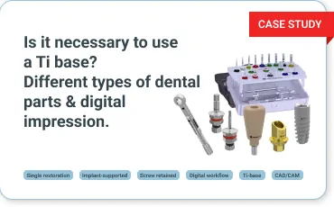 Is it necessary to use a Ti base? Different types of dental parts & digital impression