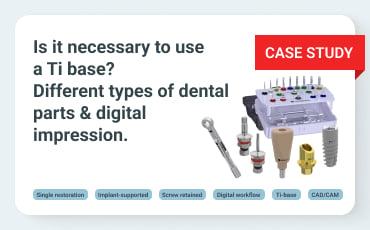 Is it necessary to use a Ti base? Different types of dental parts & digital impression