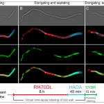 New findings on biofilm on teeth – what knowledge of the unusual mode of division of the bacterium Corynebacterium matruchotii reveals