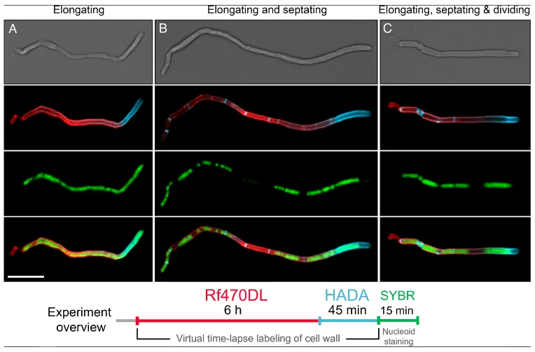 New findings on biofilm on teeth – what knowledge of the unusual mode of division of the bacterium Corynebacterium matruchotii reveals