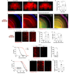 Brain aging and the fight against it: scientists have managed to stop the accumulation of F-actin protein in fruit flies (prospective study)