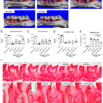 Pleasant “side effects” of immunotherapy are improved gum health: promising studies in mice