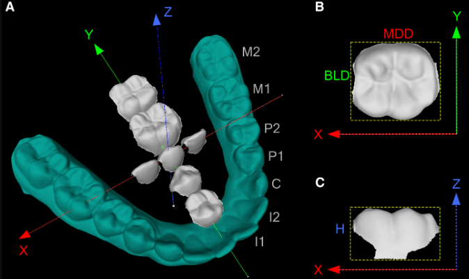 Identified genes determining the shape of teeth: another Neanderthal legacy