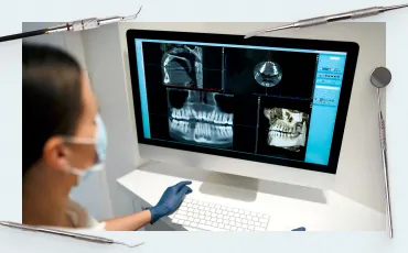 Planning Implant-Supported Restorations: From Single Tooth to Full-Arch