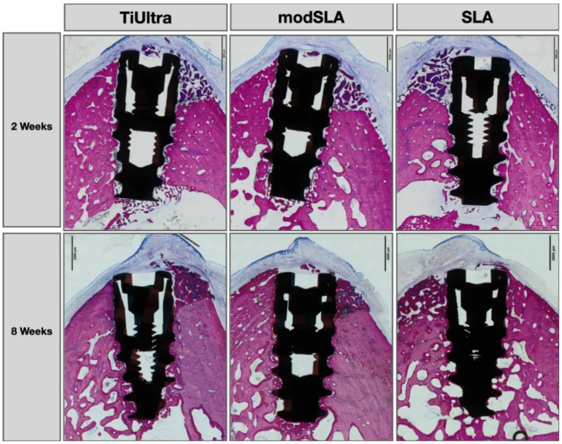 Osseointegration of Anodized vs. Sandblasted Implant Surfaces in a Guided Bone Regeneration Acute Dehiscence-Type Defect: An In Vivo Experimental Mandibular Minipig Model