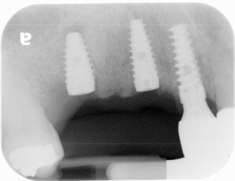 Dental x-ray view 1