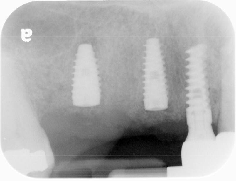 Dental x-ray view 2