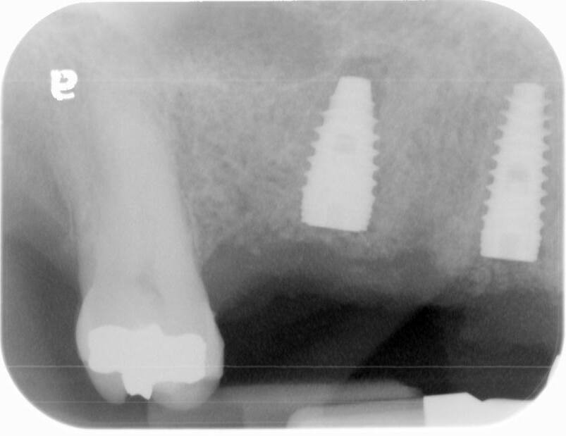 Dental x-ray view 3