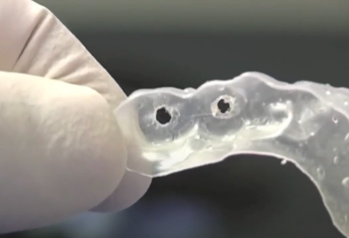 An Example Of A Celluloid Guide Attached To The Remaining Teeth Youtube / Dr. Kamil Khabiev / Dental Guru Academy An example of a celluloid guide attached to the remaining teeth youtube / dr. Kamil khabiev / dental guru academy