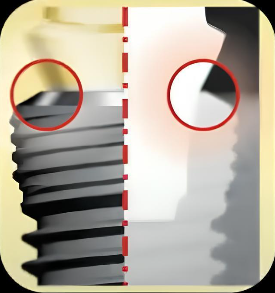 The Principle Of Platform Switching At The Implant/Abutment Level Youtube / Dr. Kamil Khabiev / Dental Guru Academy The principle of platform switching at the implant/abutment level youtube / dr. Kamil khabiev / dental guru academy