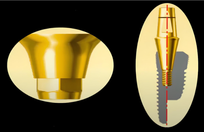 A Universal Implant/Abutment Connection For All Implant Diameters Youtube / Dr. Kamil Khabiev / Dental Guru Academy A universal implant/abutment connection for all implant diameters youtube / dr. Kamil khabiev / dental guru academy