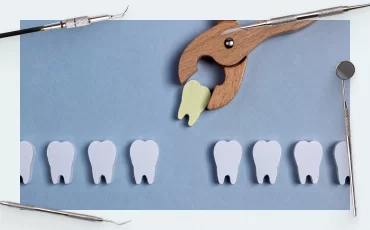 Tooth extraction, healing implantation (part 2)