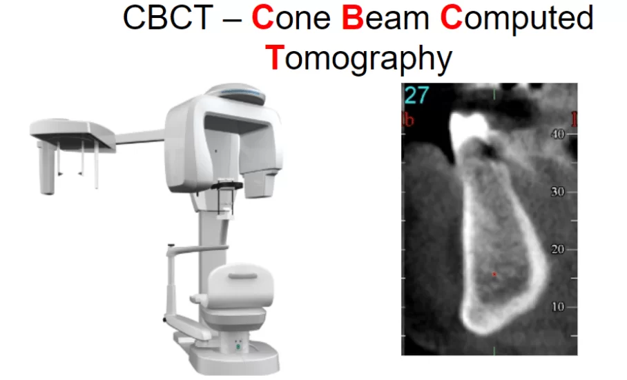 The use of cone beam computed tomography in dentistry