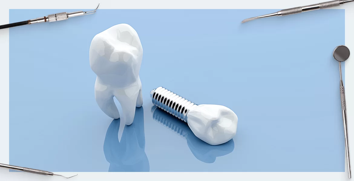 Rating of platforms for dental implantation