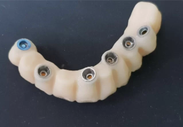 Finished prosthesis view from attachment side to multi-unit abutments