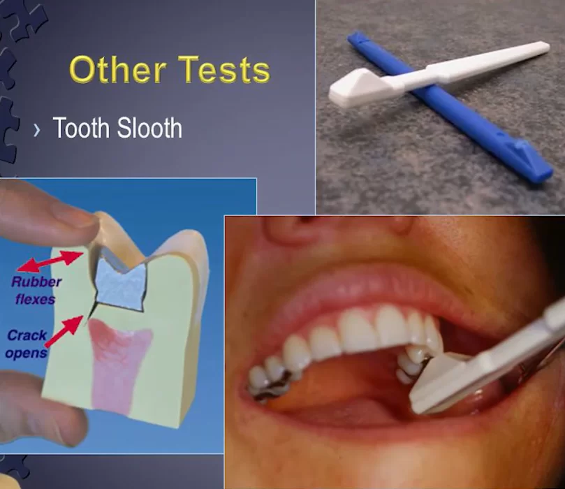 Pointed tooth slooth placed in fissure and bitten down upon reveals cracks if painful.