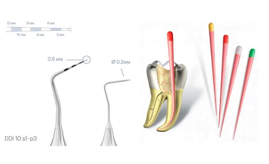 Gutta-percha pins are inexpensive, readily available, and highly effective for examining root canal spaces.