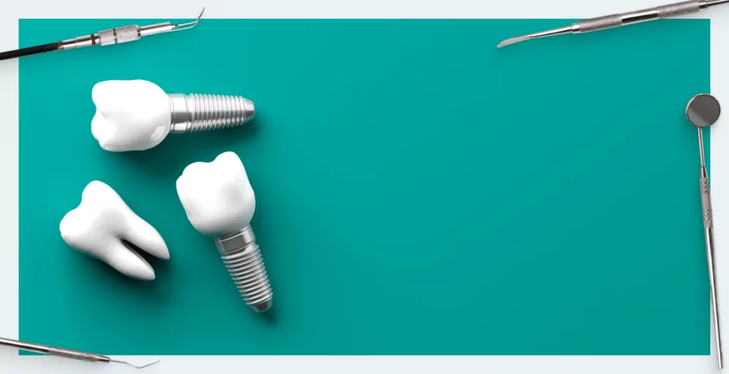 What is better, a tooth or an implant? Part 2