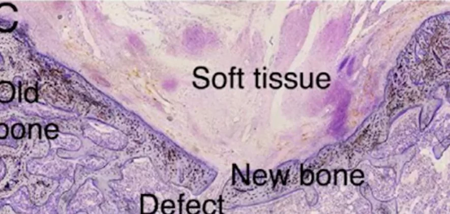 Histological section where you can see that in the case of the barrier membrane, the bone regenerated, and in the control case the bone defect remained