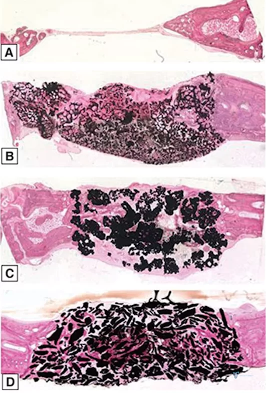 Ectopic bone overgrowth based on foreign bone material in rabbit muscle tissue