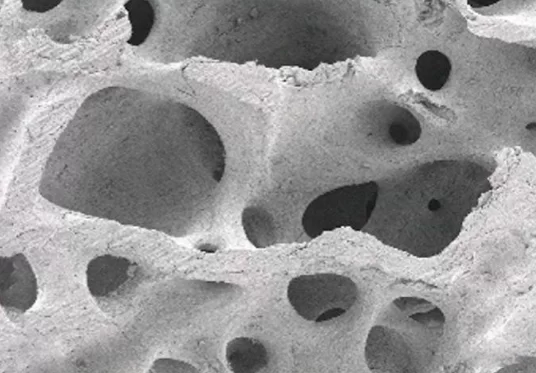 Structure of xenogeneic bone material under the microscope