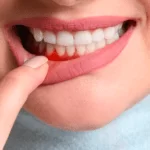Breakthrough Device for Early Detection of Gum Disease and Its Impact on Overall Health
