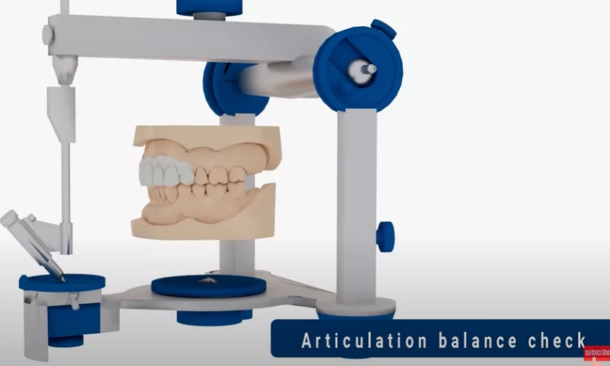 Articulator for checking the correct function of a dental prosthesis in motion