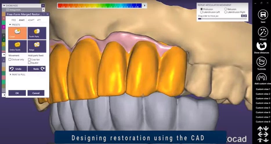 Development of a dental implant based on the data obtained from scanning