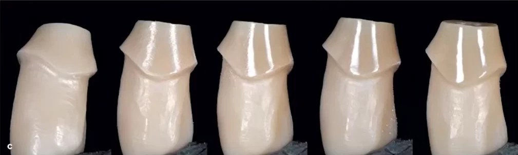 Stages of polishing a zirconia crown base