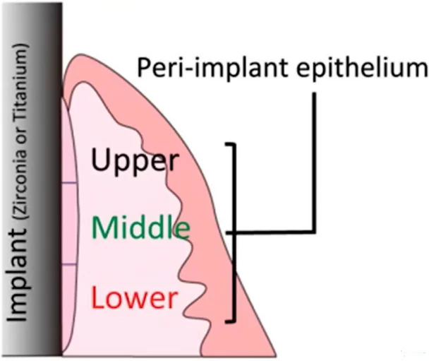 Distribution of epithelial tissues by zones in the gingival cuff