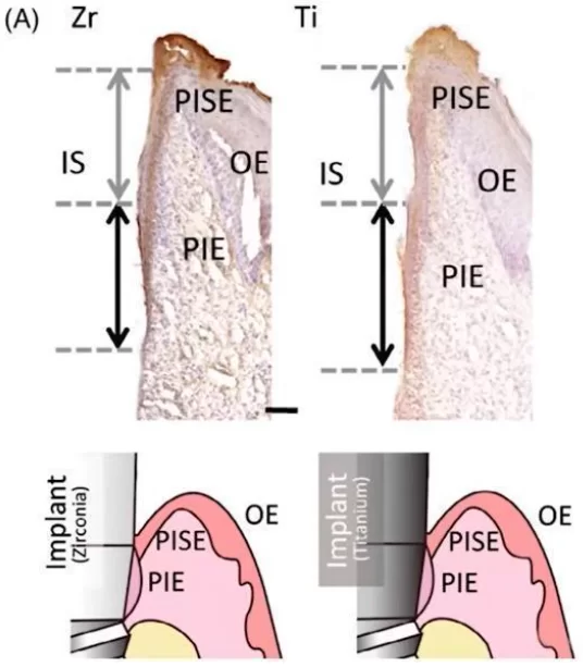 Tissue distribution of different types of epithelium in contact with titanium and zirconium surfaces