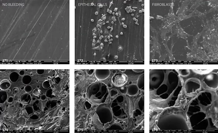 Microscope image of the composite surface on which fibroblasts and epithelial cells are grown