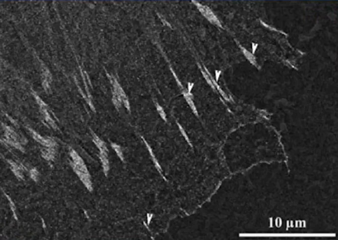 Immunogold staining and detection of vinculin in focal adhesions using backscattered electron (bse) imaging on sembse imaging of immunogold staining of vinculin in focal adhesions in e-cell on p surface focal adhesions 48 hours after seeding are marked with arrows