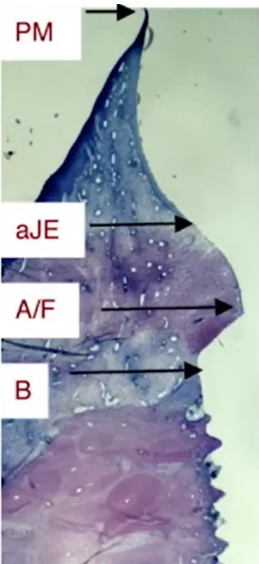 Histological section of tissue from the abutment area