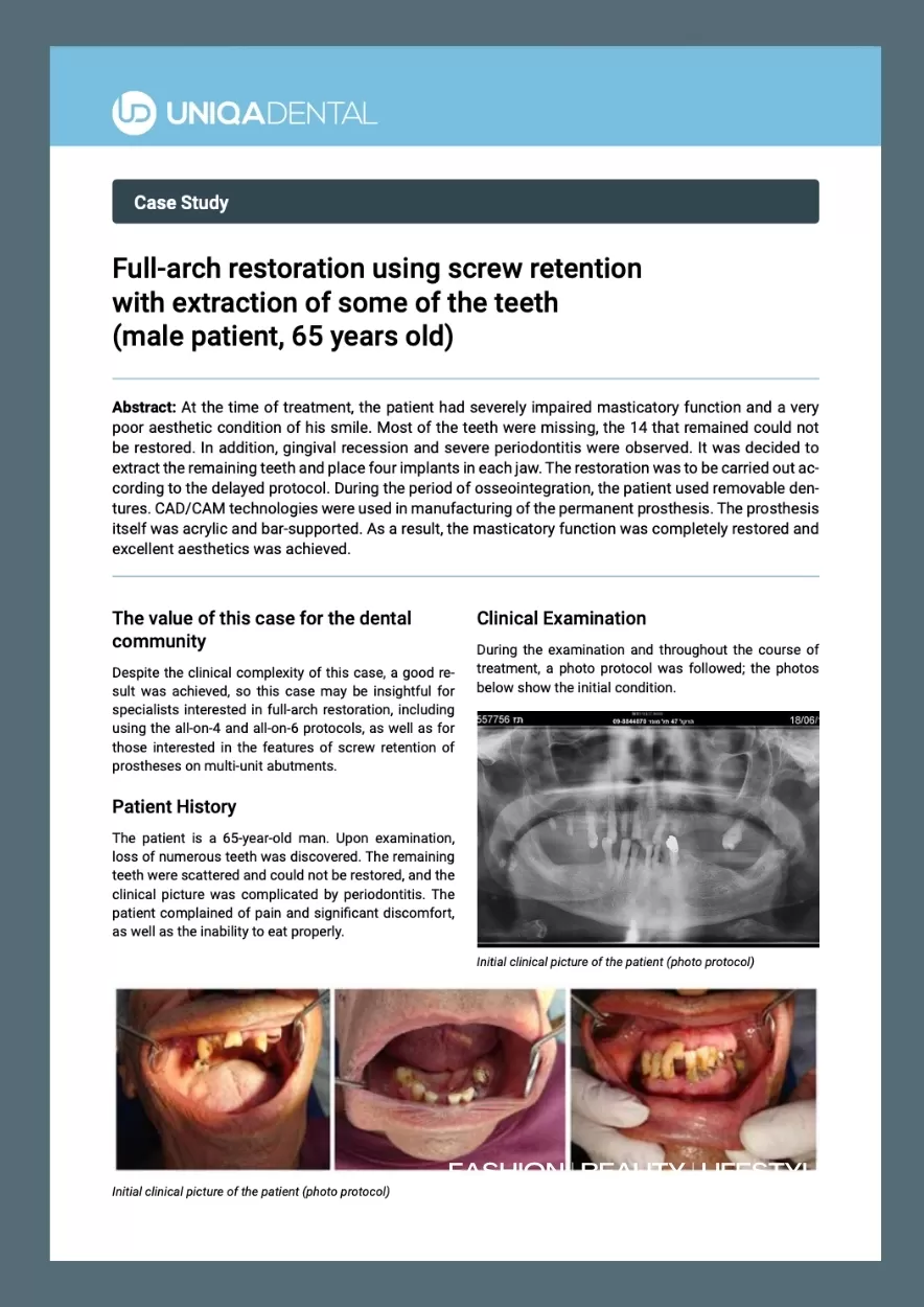Full-arch screw-retained implant-supported restoration (pdf)
