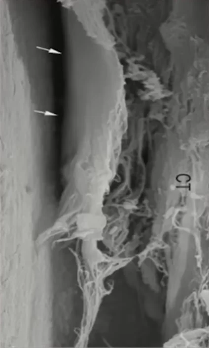 The defense architecture of the human preimplant mucosa