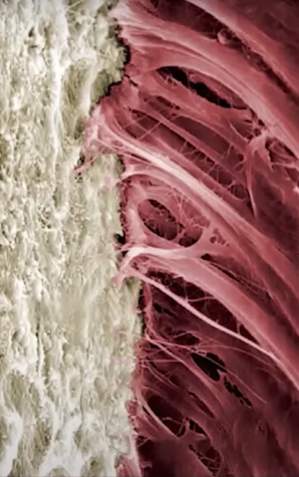 Histological section of a healthy gingival cuff around a tooth root